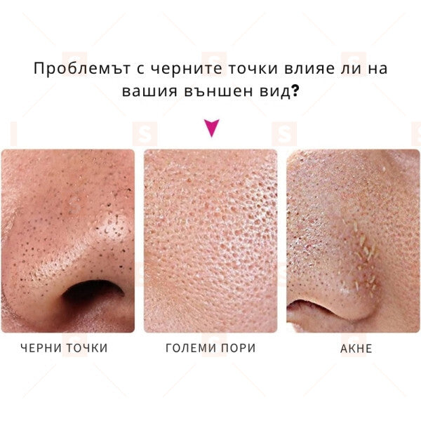 10 бр. ленти за премахване на черни точки Nose Mask – ефективно почистване на порите – подходящи за всички типове кожа – премахват замърсявания и излишен себум за чист и свеж нос